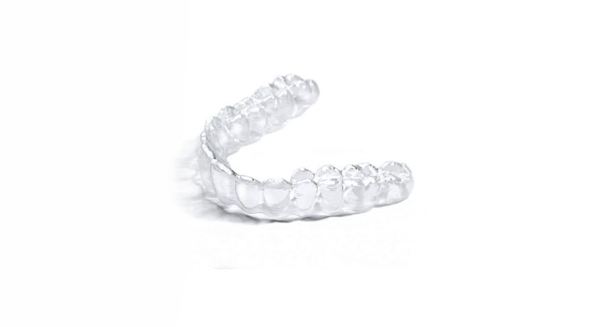 Clear Aligners