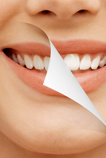 Protecting Teeth from Coffee Stains After Whitening