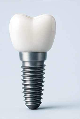Discover 5 Surprising Ways Dental Implants Enhance Your Smile