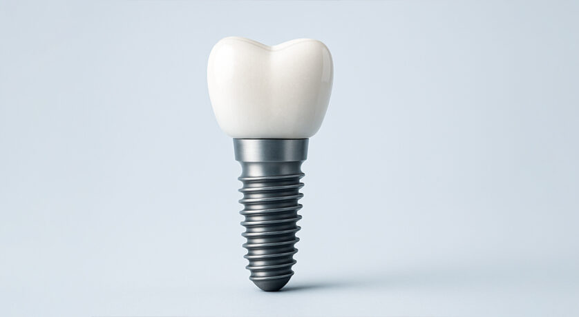 Discover 5 Surprising Ways Dental Implants Enhance Your Smile