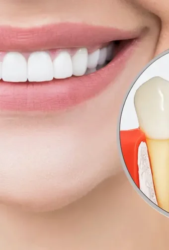 Dental implants in Hackensack, NJ.