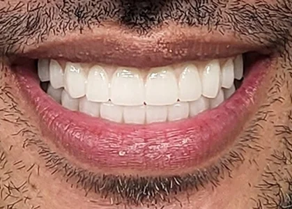 after-image